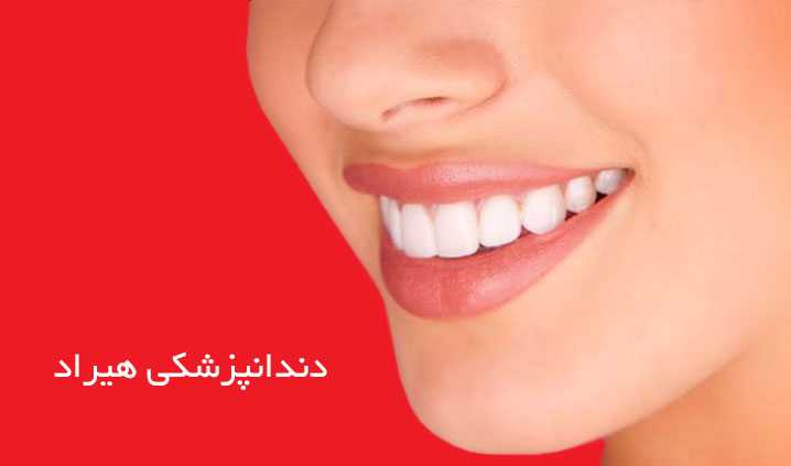 مرکز ایمپلنت در اکباتان